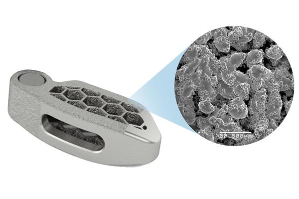 medtronic-announces-new-tionic-titanium-3d-printing-platform-for-spinal-implants-1.jpg